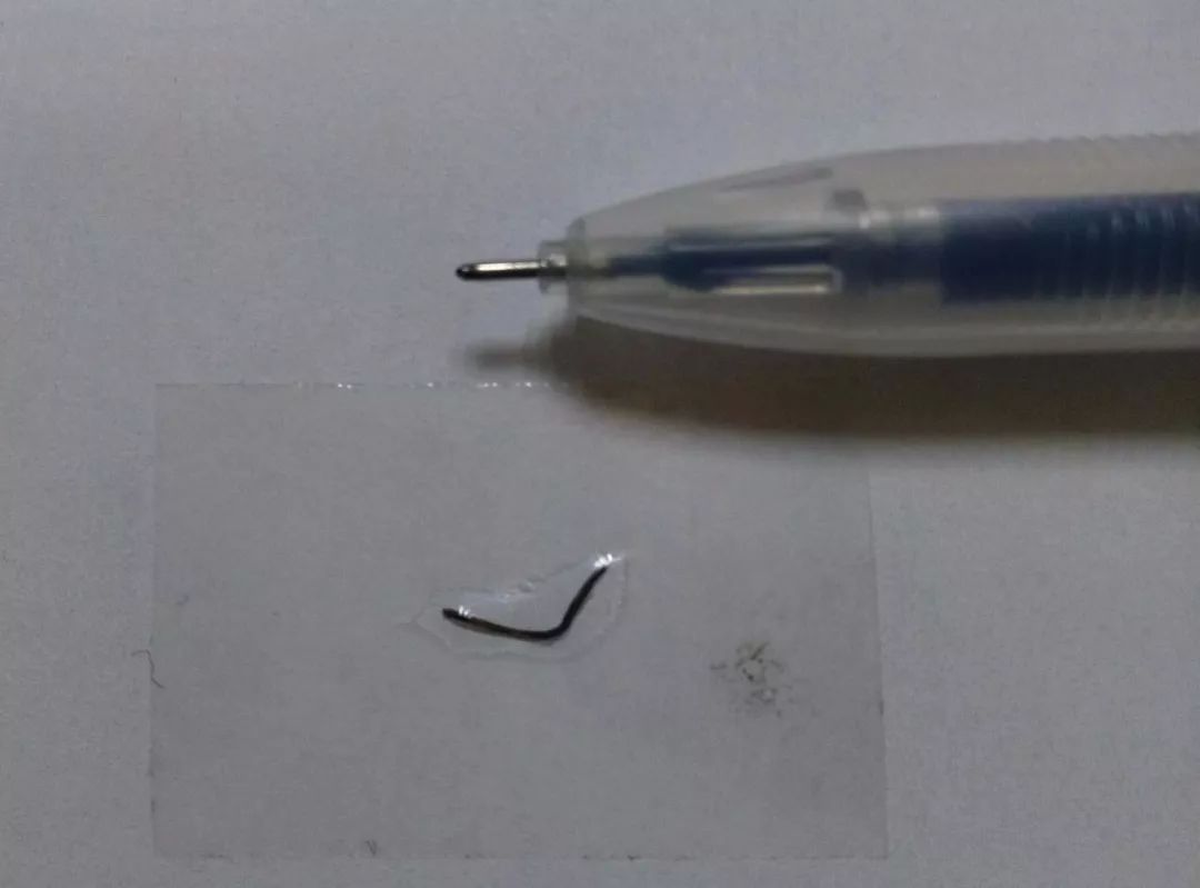 37歲女工眼球穿通傷，專家：越早就醫(yī)越好